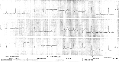 Figure 3B